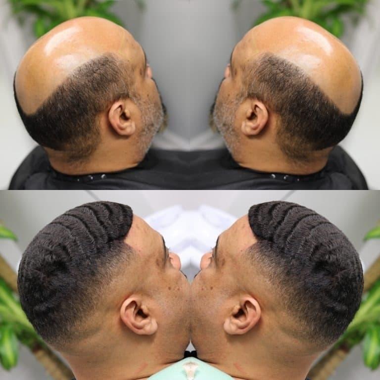 Essential step by step tips on how to take off lace wig safely and protect your natural hair