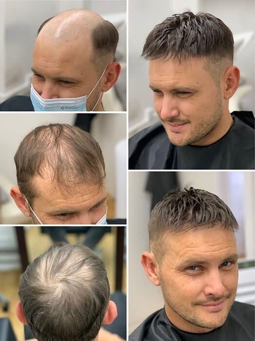 New evidence reveals why was lyle wearing a wig and how it changed the investigation