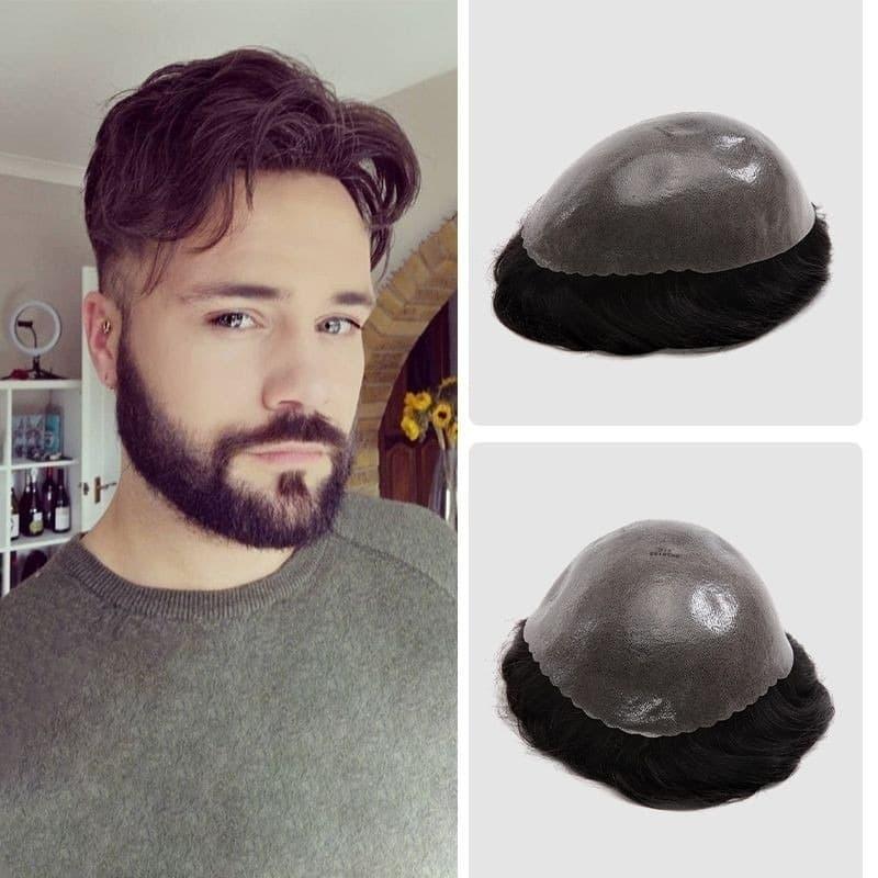 how to claim wigs through insurance Step-by-Step Checklist and Documentation Tips for 2025