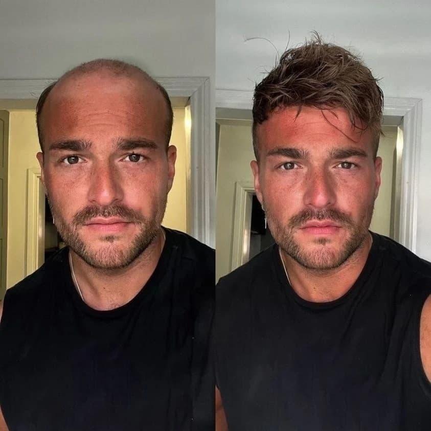 Where Do Wigs Originate From? Tracing the Global History, Cultural Uses and Modern Trends